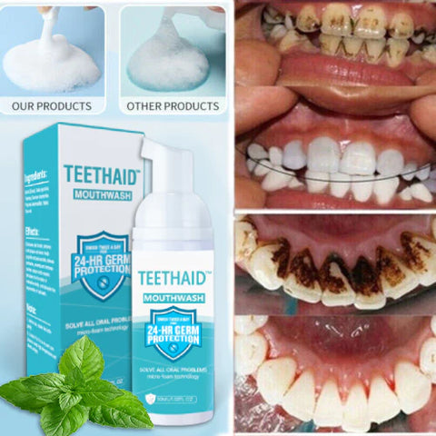 Image of 🔥"Teethaid™🔥 Enjuague bucal, blanqueamiento dental, Curación de úlceras bucales, Eliminación del mal aliento, Prevención y curación de caries