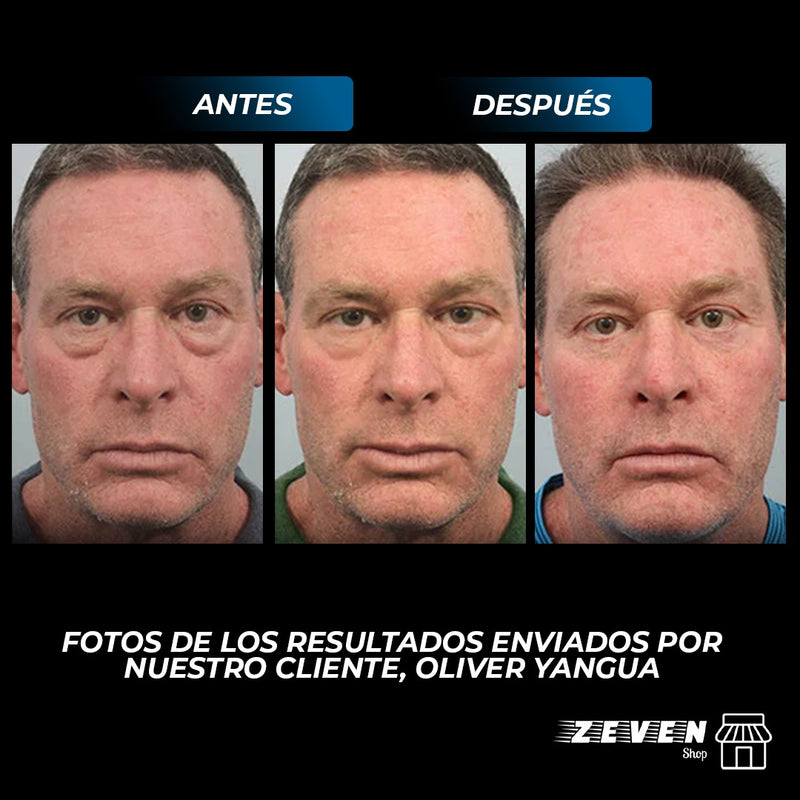 OPEN EYES™ NUEVA CREMA PARA OJOS